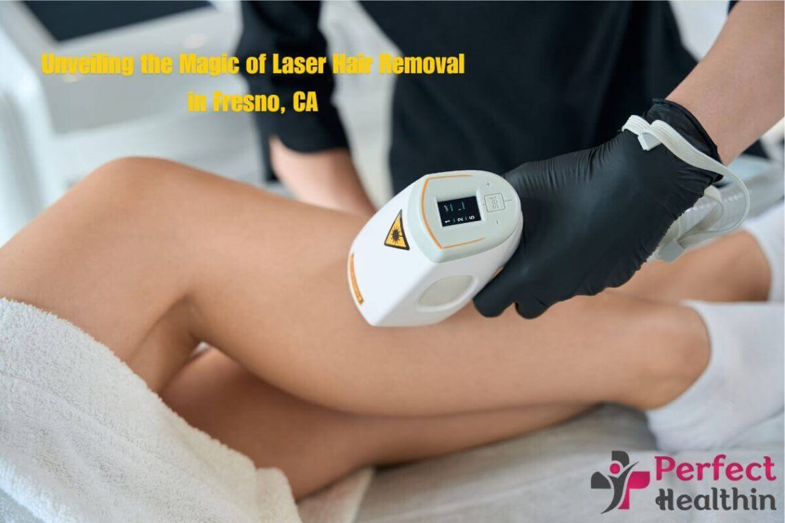 Unveiling the Magic of Laser Hair Removal in Fresno, CA